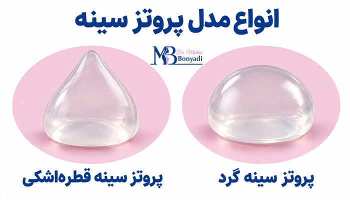 انواع مدل پروتز سینه